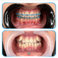ارتودنسی